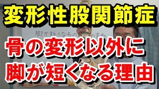 【変形性股関節症】骨の変形以外に脚が短くなる理由｜愛知県江南市の慢性痛専門整体院‐爽快館