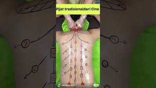 Traditional Chinese Massage: Ancient Healing Techniques for Wellness #relaxation #wellnessforlife