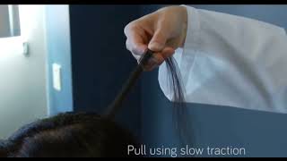 Hair pull test technique |Telogen effluvium |Alopecia