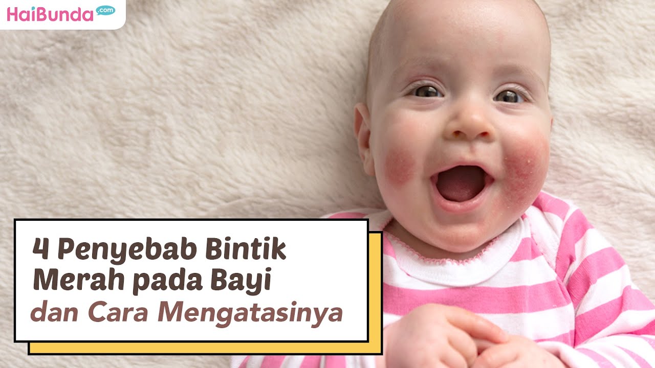 4 Penyebab Bintik Merah Pada Bayi Dan Cara Mengatasinya - YouTube