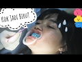 Behel & Bleaching Experience | Indira Kalistha
