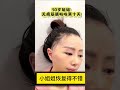 50岁小姐姐恢复10天后 太满意了 自信 开心 美女 整形