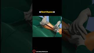 Heart Bypass Surgery Procedure - 3D video _ #cardiology #short