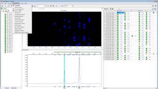 Trisomy-Aneuploidy Analysis Using GeneMarker®