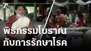 พิธีกรรมโบราณกับการรักษาโรค | 17-04-65 | ตะลอนข่าวสุดสัปดาห์