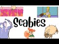 Scabies | Dermatology (Pathophysiology,clinical features,diagnosis,treatment) MedVidsMadeSimple