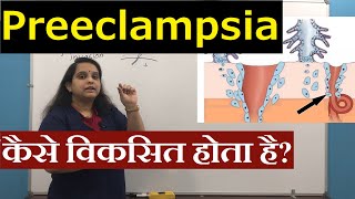 Pathogenesis of Preeclampsia in Hindi (हिंदी) | Pregnancy induced Hypertension | Nursing Lecture