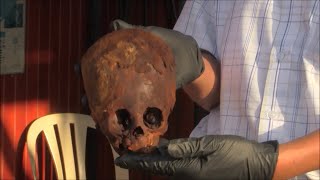 Unwrapping A 2400 Year Old Blonde Elongated Mummy Head Of Paracas Peru