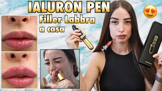 🇮🇹 FILLER LABBRA A CASA 💉 IALURON PEN 👄  Auto iniezione di acido ialuronico a casa