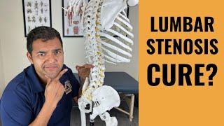 Can Painful Lumbar Spinal Stenosis Actually Be Cured? (Controversial)