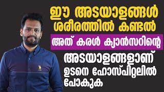 ഈ അടയാളങ്ങൾ ശരീരത്തിൽ കണ്ടാൽ കരൾ കാൻസർ വരാൻ സാധ്യതയുണ്ട്  | liver cancer