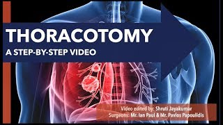 CTSNet Step-by-Step Series: Posterolateral Thoracotomy