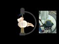 fluoroscopic technique for open reduction and internal fixation of proximal humeral fracture...