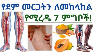 የደም መርጋትን የሚከላከሉ እና የረጋ ደምን የሚያሳሱ 7 ምግቦች| የደም መርጋት| Clots | Foods naturally dissolve blood clots