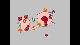 The metastatic thrombus HD