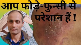 #बालतोड़, #फोड़ा, #Boils, #Carbuncle, #Homeopathic Medicine for Boils. By Dr K K Pandey