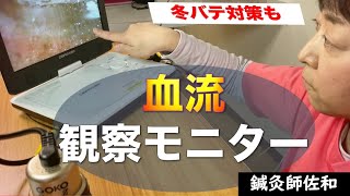 【血流観察モニター】ってこんなのです！毛細血管、大丈夫？