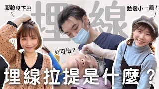 埋線拉提很痛嗎😱？肉臉變小V臉30天全記錄！｜Evanna凡娜