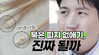 모공이 고민이신 분들을 위한, 맨들맨들 아기코 만드는 방법👶🏻👃🏻 (+ 찐으로 효과 본 모공관리법 ) | 채우 chaewoo