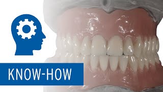Industry Experts Insights October Edition – Digital Dentures - A Curse or Chance?