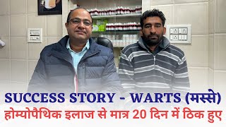 Warts Success Story | होम्योपैथीक इलाज से मात्र 20 दिनों में मस्से जड़ से ठीक हुए