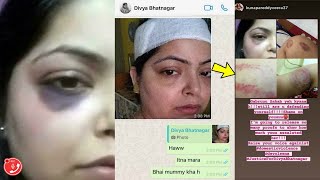 Divya Bhatnagar Audio Call Recording REVEALED Real MONSTER Face Of Her Husband Gagan Gabru!!