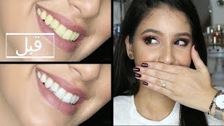 تجربتي مع وصفات طبيعية لتبيض الأسنان | Rawaa Beauty