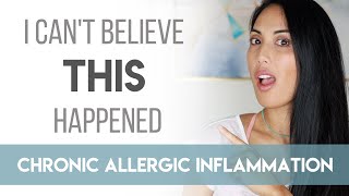 SO HORRIBLE... Fatigue Came Back! - Chronic Allergic Inflammation