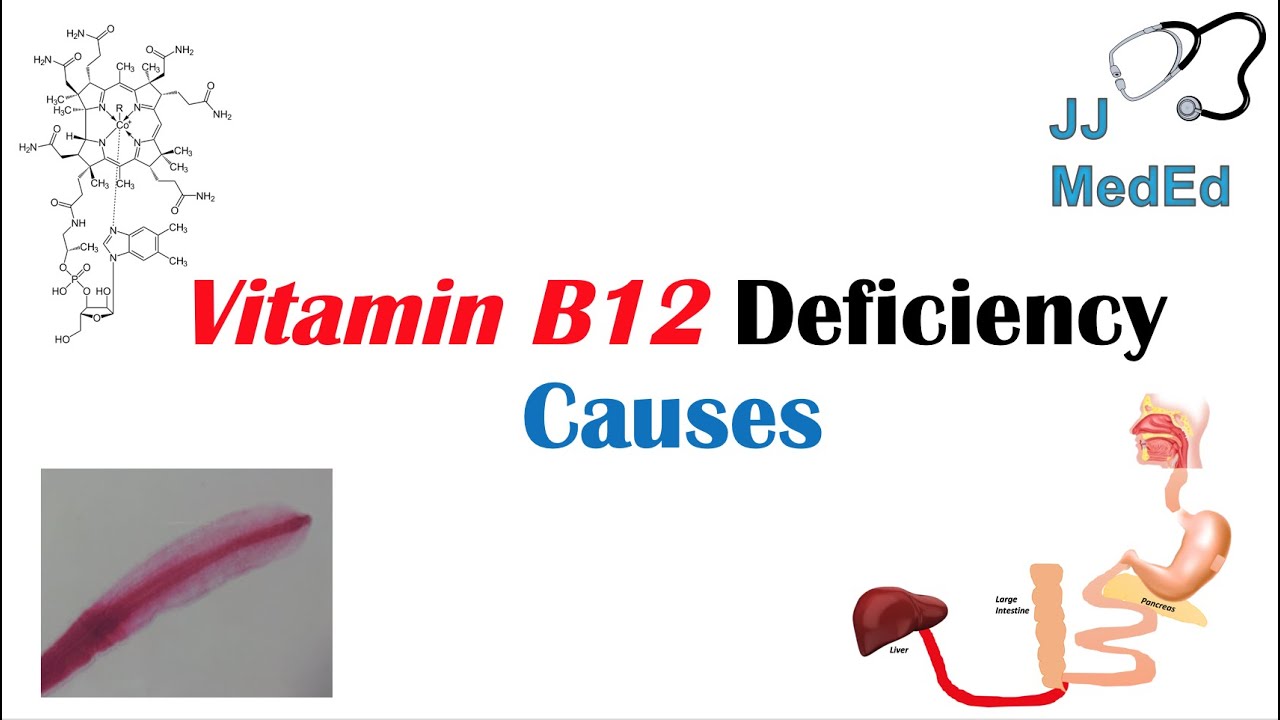 Vitamin B12 Deficiency Diseases