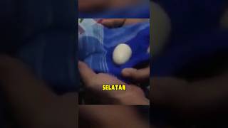 kisah viral bocah bertelur dari sulawesi selatan 🗿 #short