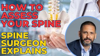 How to assess your spine – Spine surgeon explains