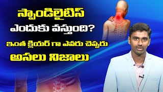 స్పాండిలైటిస్ ఎందుకు వస్తుంది? Spondylitis Symptoms In Telugu | Spondylitis Treatment In Telugu