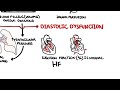 hfpef heart failure with preserved ejection fraction