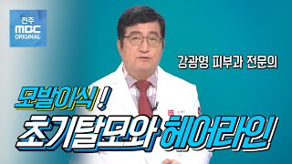 [닥터 MBC] 전주모래내피부과 강광영 원장 - 초기탈모와 헤어라인의 모발이식