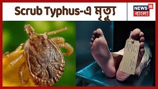 Medinipur-এ Scrub Typhus-এ মৃত্যু এক শিশু কন্যার