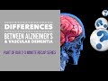 What is the difference between Alzheimer's & Vascular Dementia?