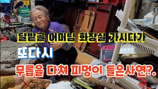 달밭골 어머님 화장실 가시다가 넘어져 또다시 무릅을 다쳐 피멍이 들은 사연?.