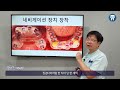 치아가 없어도 임플란트로 제2의 치아를 만들 수 있는 무치악임플란트