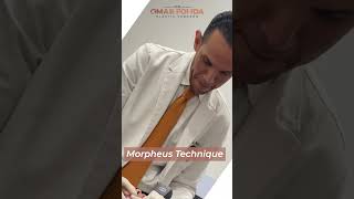 Facelift thorough Morpheus technique..By DR.Omar Fouda