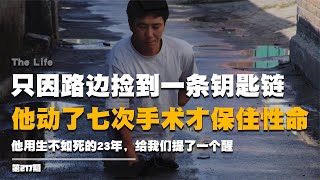 只因路邊撿到一條鑰匙鏈，他動了七次手術才保住性命，《生死鏈》 #纪实 #醫療紀錄片 #生命緣 #醫院 #紀錄片