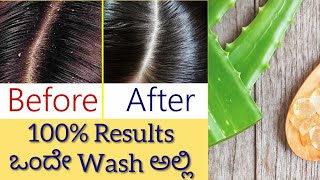 ತಲೆ ಕೂದಲು ಹೊಟ್ಟು, ಡ್ಯಾಂಡ್ರಫ್ ಹೋಮ್ ರೆಮಿಡೀಸ್ I| Dandruff Home Remedies || Miracle Cure For Dandruff