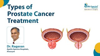 Prostate Cancer – Diagnosis \u0026 Treatment | Dr. N Ragavan