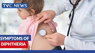 (MUST WATCH) What Is Diphtheria And Signs You Must Look Out For
