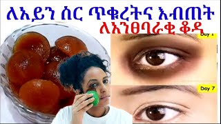 በ1ሳምንት ለአይን ስር ጥቁረት እና እብጠት #Coffee_ice_for_face  #removedarkcircle #removepuffiness #glowingskin