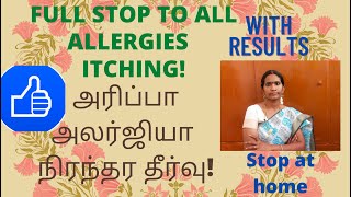 Skin Allergy Treatment at home Tamil | தோலில் ஏற்படும் அனைத்து விதமான அரிப்புக்கும் சூப்பர்மருந்து