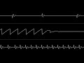 Orcan - “Back to Melody” (C64) [Oscilloscope View]