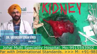 kidney stone patient testimonial | Johal Hospital Jalandhar