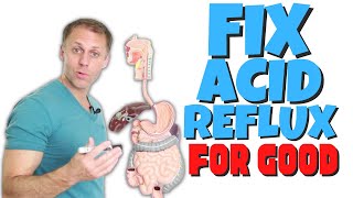 Understanding Acid Reflux | Fix Heartburn Naturally