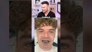 Dentist Reviews Turkey Teeth Transformation! 😮🦷