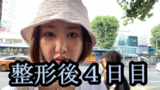 【整形４日目】まゆ‼整形４日目の女６月１８日